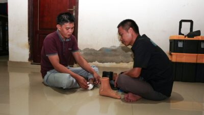 Peduli Disabilitas, PT IMIP Berikan Bantuan Kaki Palsu