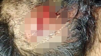 Diduga Cemburu, Oknum ASN di Morowali Aniaya Warga Desa Laroue Hingga Kepala Luka dan Tangan Kiri Patah